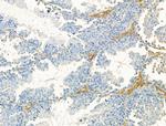 DYNC1I1 Antibody in Immunohistochemistry (Paraffin) (IHC (P))