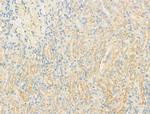 DYNC1I1 Antibody in Immunohistochemistry (Paraffin) (IHC (P))