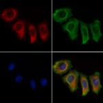 DBT Antibody in Immunocytochemistry (ICC/IF)