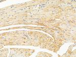 Desmin Antibody in Immunohistochemistry (Paraffin) (IHC (P))