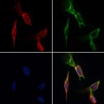 Desmin Antibody in Immunocytochemistry (ICC/IF)