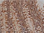 Desmin Antibody in Immunohistochemistry (Paraffin) (IHC (P))