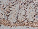 Desmin Antibody in Immunohistochemistry (Paraffin) (IHC (P))