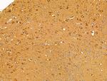 Desmin Antibody in Immunohistochemistry (Paraffin) (IHC (P))