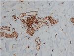 Desmin Antibody in Immunohistochemistry (Paraffin) (IHC (P))