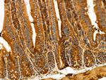 Desmin Antibody in Immunohistochemistry (Paraffin) (IHC (P))