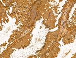 Desmin Antibody in Immunohistochemistry (Paraffin) (IHC (P))