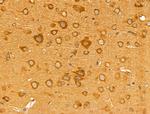 Desmin Antibody in Immunohistochemistry (Paraffin) (IHC (P))