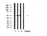 Desmin Antibody in Western Blot (WB)