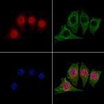 DFFB Antibody in Immunocytochemistry (ICC/IF)