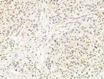 DFFB Antibody in Immunohistochemistry (Paraffin) (IHC (P))