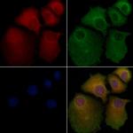 DHFR Antibody in Immunocytochemistry (ICC/IF)