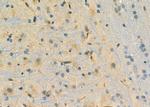 DHFR Antibody in Immunohistochemistry (Paraffin) (IHC (P))