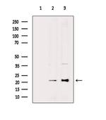 DHFR Antibody in Western Blot (WB)