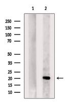 DHFR Antibody in Western Blot (WB)