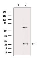 DHFR Antibody in Western Blot (WB)