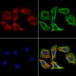 DHH Antibody in Immunocytochemistry (ICC/IF)