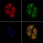 DHRS4 Antibody in Immunocytochemistry (ICC/IF)