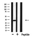 DHRS4 Antibody in Western Blot (WB)