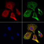 DIAPH3 Antibody in Immunocytochemistry (ICC/IF)