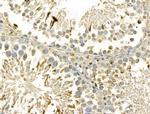 DIAPH3 Antibody in Immunohistochemistry (Paraffin) (IHC (P))