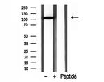 DIAPH3 Antibody in Western Blot (WB)