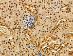 Dicer Antibody in Immunohistochemistry (Paraffin) (IHC (P))