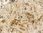 Dicer Antibody in Immunohistochemistry (Paraffin) (IHC (P))