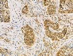 Dicer Antibody in Immunohistochemistry (Paraffin) (IHC (P))