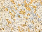 Dicer Antibody in Immunohistochemistry (Paraffin) (IHC (P))