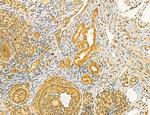 Dicer Antibody in Immunohistochemistry (Paraffin) (IHC (P))