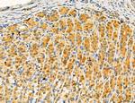 Dicer Antibody in Immunohistochemistry (Paraffin) (IHC (P))