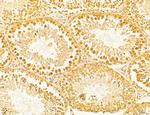 Dicer Antibody in Immunohistochemistry (Paraffin) (IHC (P))