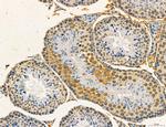 Dicer Antibody in Immunohistochemistry (Paraffin) (IHC (P))