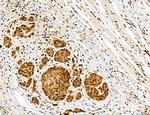 Dicer Antibody in Immunohistochemistry (Paraffin) (IHC (P))