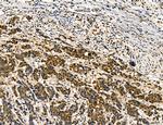 Dicer Antibody in Immunohistochemistry (Paraffin) (IHC (P))