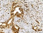 Dicer Antibody in Immunohistochemistry (Paraffin) (IHC (P))