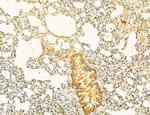 Dicer Antibody in Immunohistochemistry (Paraffin) (IHC (P))