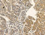 Dicer Antibody in Immunohistochemistry (Paraffin) (IHC (P))