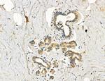 Dicer Antibody in Immunohistochemistry (Paraffin) (IHC (P))