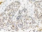 DLST Antibody in Immunohistochemistry (Paraffin) (IHC (P))