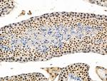 DLST Antibody in Immunohistochemistry (Paraffin) (IHC (P))