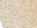 DLST Antibody in Immunohistochemistry (Paraffin) (IHC (P))