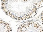 DLST Antibody in Immunohistochemistry (Paraffin) (IHC (P))