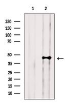 DLST Antibody in Western Blot (WB)