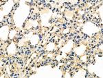 RNA pol II CTD Antibody in Immunohistochemistry (Paraffin) (IHC (P))