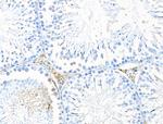 DNase II Antibody in Immunohistochemistry (Paraffin) (IHC (P))