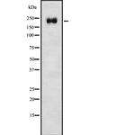 DOCK2 Antibody in Western Blot (WB)