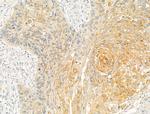 DPP9 Antibody in Immunohistochemistry (Paraffin) (IHC (P))