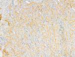 DPP9 Antibody in Immunohistochemistry (Paraffin) (IHC (P))